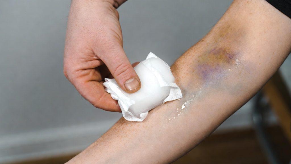 Gheața (primele 24 de ore)